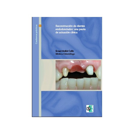 Reconstrucción dientes endodonciados - Ernest Mallat Callis