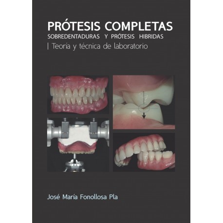 Prótesis Completas - José Mª Fonollosa Pla